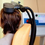 rTMS در بهبود اختلال دوقطبی