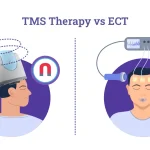 تفاوت آر تی ام اس با شوک درمانی (ECT) چیست؟